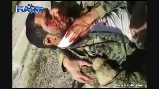 لحظه دردناک شهید شدن سرباز عراقی و گریه های همرزمش