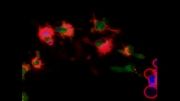 مرگ برنامه ریزی شده سلول-آپوپتوز