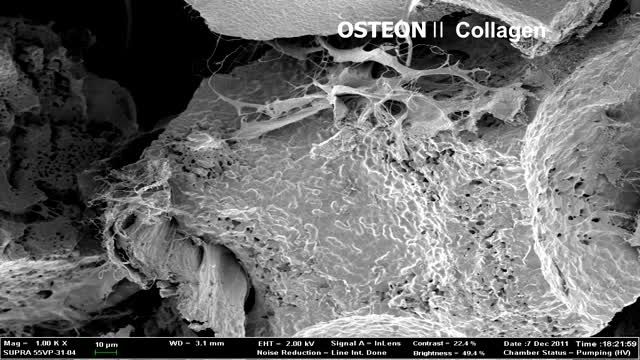 OSTEONⅡ Collagen