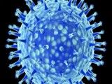 Pig Flu Symptoms, An H1N1 pandemic flu strain mutating with Avian Flu