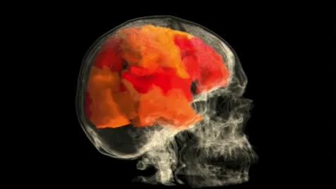 نگاهی به مغز یک خانم در هنگام ارگاسم در زیر دستگاه MRI
