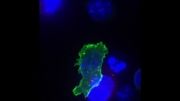 حمله سلول های T کشنده به سلول های سرطانی