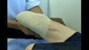 stumps bandaging technique