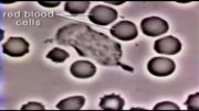 کلیپ خورده شدن باکتری توسط گلبول سفید در خون انسان