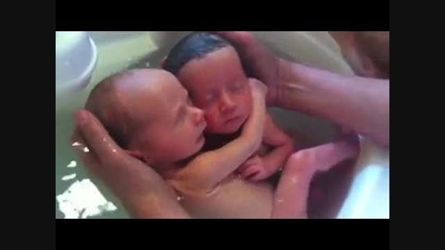 دوقلوهایی که پس از تولد هم یکدیگر را در آغوش گرفته اند