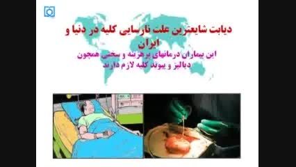 دیابت شایعترین علت نارسایی کلیه در دنیا و ایران