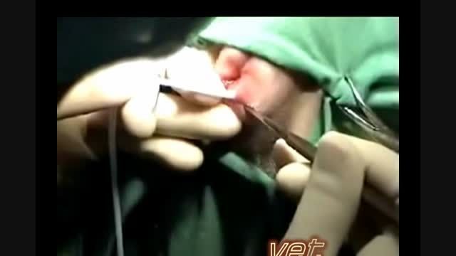 جراحی کیسه مقعدی- anal sac surgery