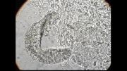 انگل آبشش gill flukes زیر میکروسکپ-2