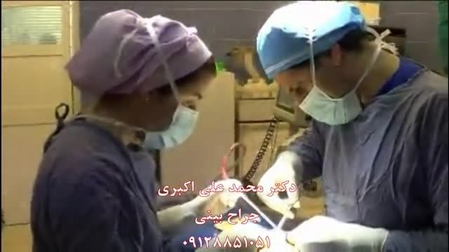 جراحی بینی-قسمت 2