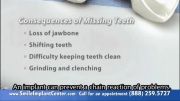 A Single Implant - Why Replace Missing Teeth