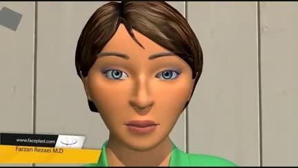 انیمیشن جراحی زیبایی بینی