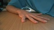 تاندون های اجباری - کنترل انگشتها