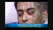 اسید پاشی این سری رو صورت رئیس بیمارستان ضیاییان تهران