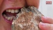 خوردن سنگ توسط زن 45 ساله