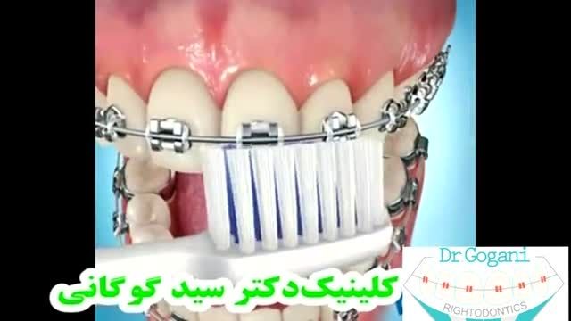 ارتودنسی و بهداشت دندان ها