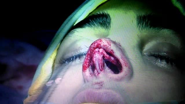 دکتر عادل محمدی جراحی زیبایی بینی و صورت