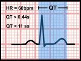 5  Time and the ECG (Section 1_ Part 5)