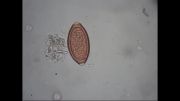 تخم ترایکوریس ترایکورا و تخم آسکاریس لومبریکوئیدس