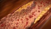 P16-Atherosclerosis