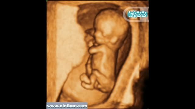 سونوگرافی چهار بعدی در بارداری هفته یازدهم(3)