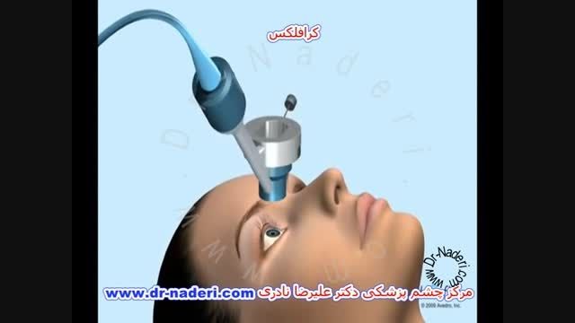 انیمیشن کرافلکس- مرکز چشم پزشکی دکتر علیرضا نادری