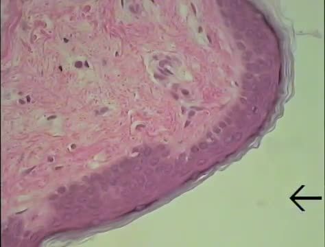 Integumentary System Histology (FreeMedEd)
