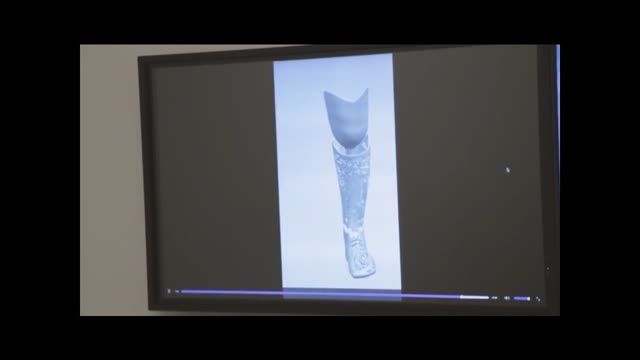 پای مصنوعی با پرینتر سه بعدی