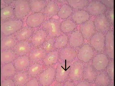 Male Reproductive Histology- Testis (FreeMedEd)