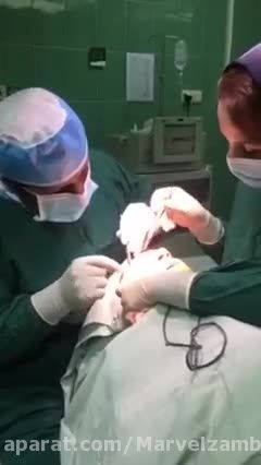 اوازخوندن زن هنگام عمل جراحی