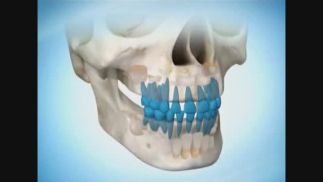 مراحل رشد دندان