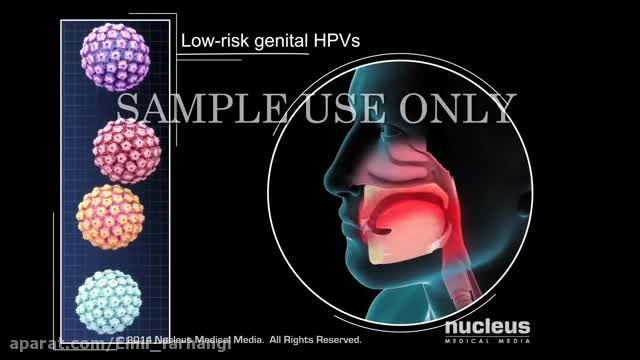 ویروس HPV یا همان زگیل Human Papillomavirus