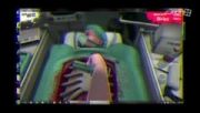 بازی عمل جراحی Surgeon-Simulato.2013