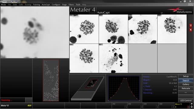 AutoCapt - Automated Image Acquisition with Metafer