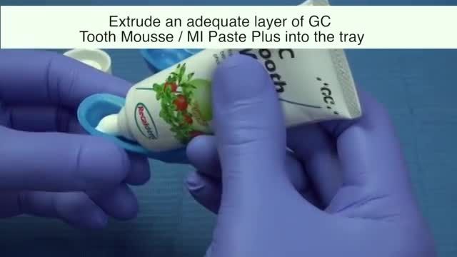 GC Mi Paste و GC Tooth Mousseخمیر موضعی جهت تقویت دندان