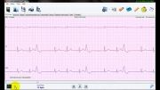 نرم افزار تحلیل سیگنال هولتر ECG نسخه 3 -  زوم