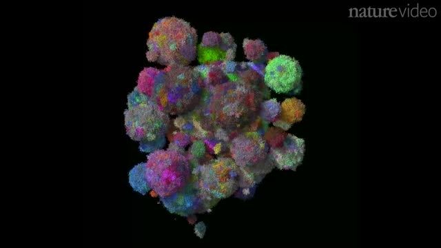 رشد تومورهای سرطانی در تصاویر رنگی - زومیت