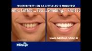 سفید کننده دندان وایت لایت | Mizban-Shop.ir