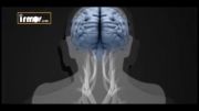 فیلم مستند مرگ مغزی (قسمت دوم)