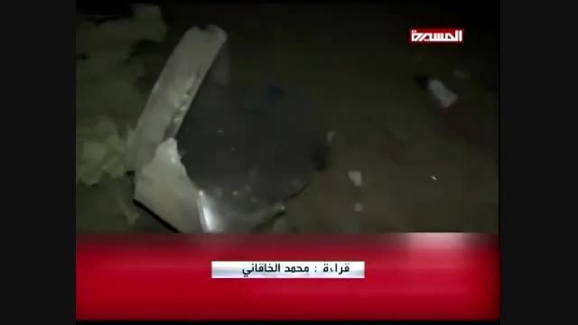 تصاویر هولناک حملات آل سعود به یمن (+18 لطفا)