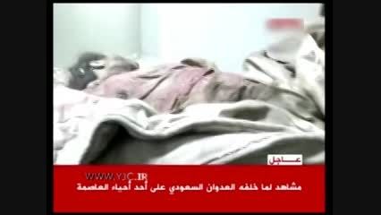 نخستین تصاویر از کودک کشی سعودی ها(وهابی ها) در یمن