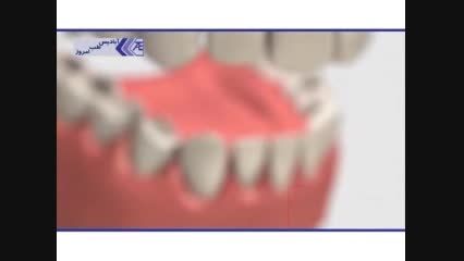 درمان های رایج در دندانپزشکی