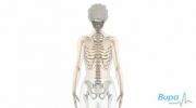 How idiopathic scoliosis occurs