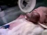 تولد وحشتناک یک کودک به طوری که قلب از بدن جداست