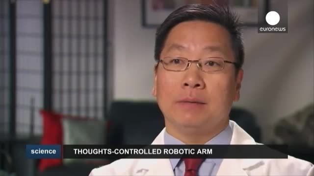 کنترل اندامها مصنوعی با قرار دادن ایمپلنت در مغز بیمار