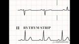 5-1 Time and the ECG Section 1.5_ Part 1