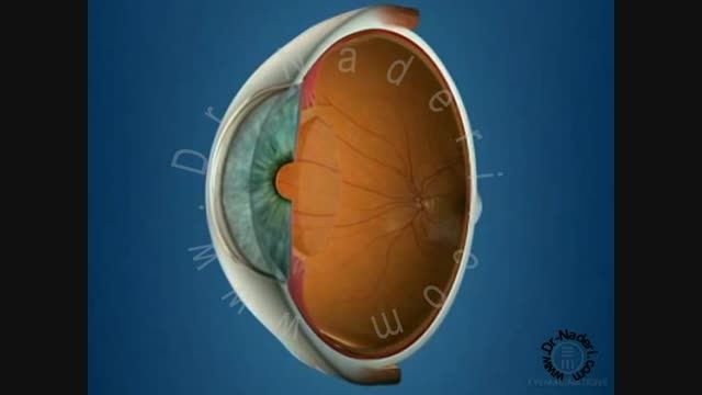مکانیسم ایجاد آب سیاه- مرکز چشم پزشکی دکتر علیرضا نادری