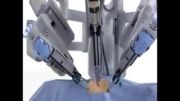 جراحی با کمک ربات داوینچی