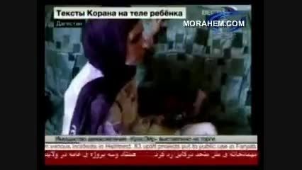 ظاهر شدن آیه قرآن روی پوست یک نوزاد در داغستان
