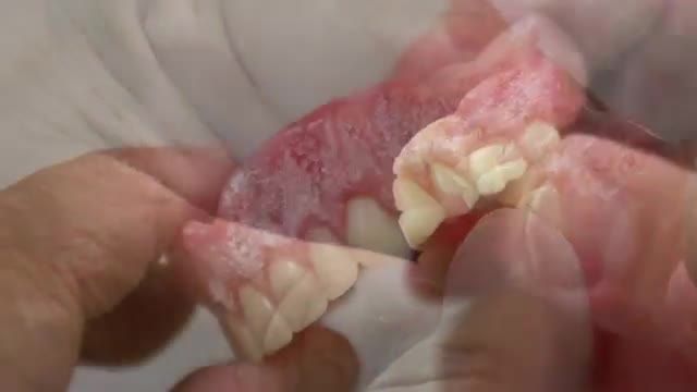 مراحل کامل ساخت دندان با پودر پرسلن قسمت 5