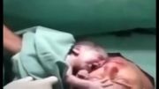 نوزادی که بعد از تولد دوست نداره از مادرش جدا بشه